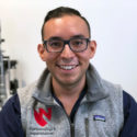 Dan Agraz, MD SMILE for astigmatism patient