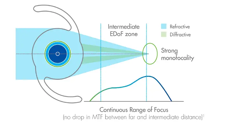 extended depth of focus iols