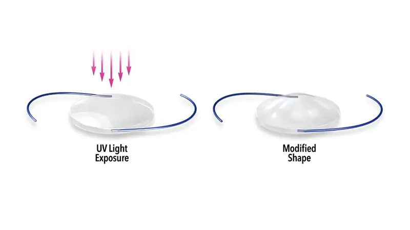 light-adjustable-lenses