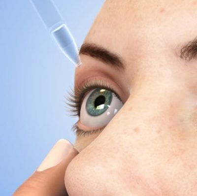 animated person putting in eye drops for dry eyes